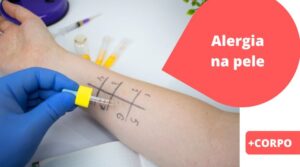 ALERGIA NA PELE – alguém próximo te irrita e incomoda