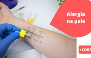 ALERGIA NA PELE – alguém próximo te irrita e incomoda